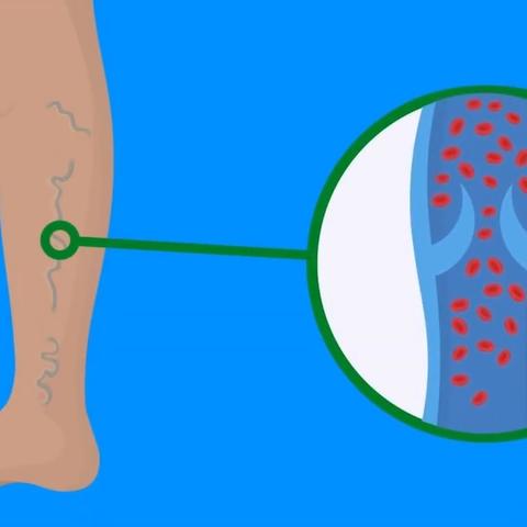 leglegs最新动态，时尚潮流新标杆
