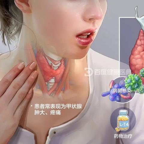 最新甲亢指南，全面解读治疗与管理策略